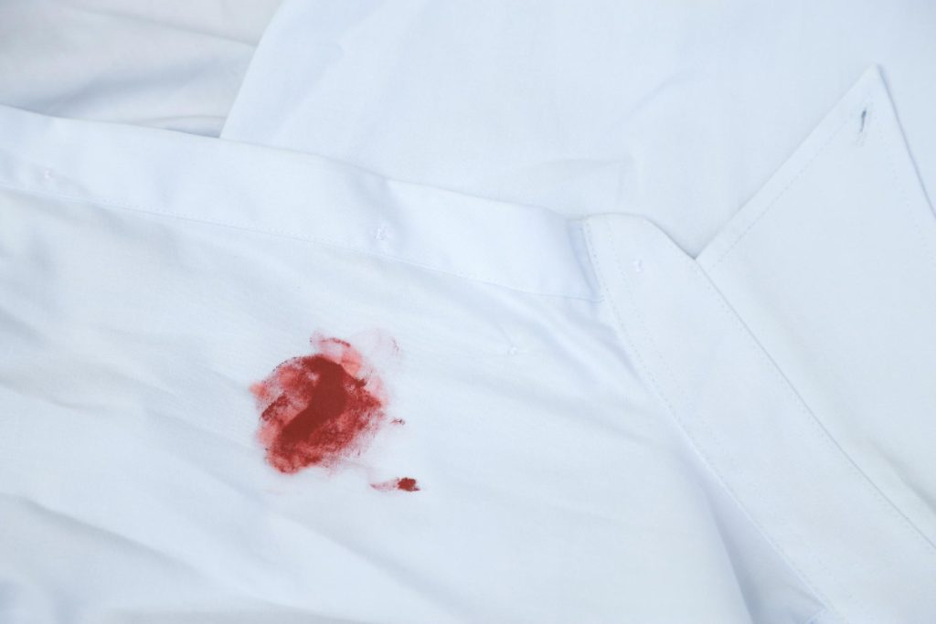 چگونه لکه‌های رایج مانند خون یا دارو را از روپوش سفید پاک کنیم؟